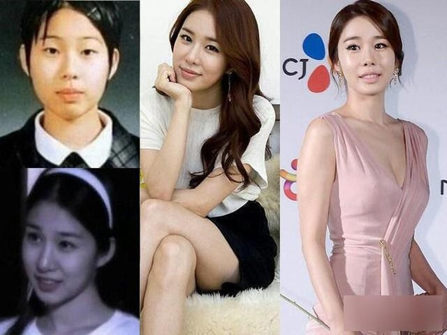 Park Min Young, Lee Da Hae và dàn mỹ nhân vịt hóa thiên nga nhờ dao kéo, nhìn ảnh quá khứ mà chấn động - Hình 9