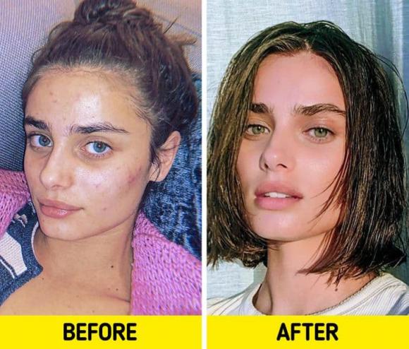 5 cách tự nhiên để thoát khỏi mụn và bí quyết giúp da luôn mịn màng, tươi trẻ - Hình 2