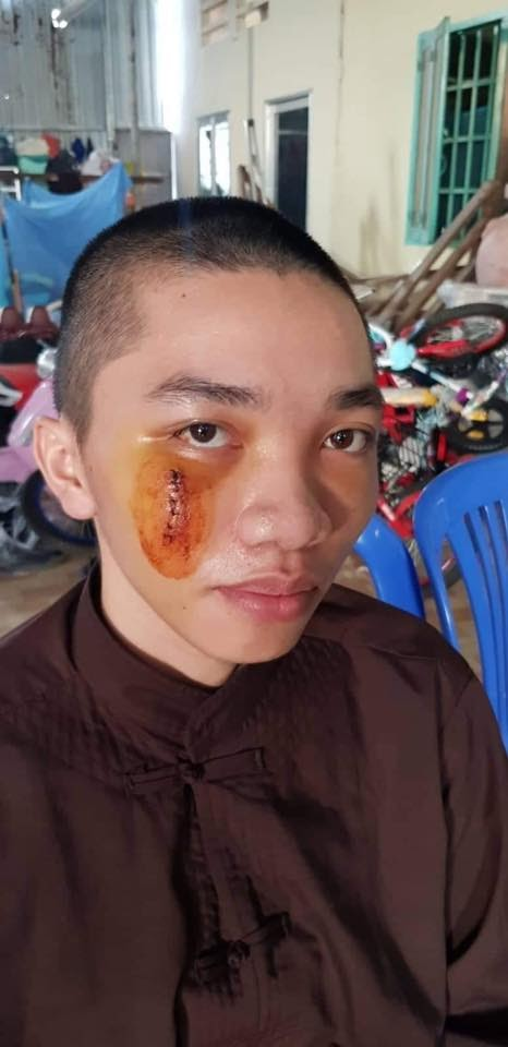 Nhị Nguyên (Tịnh Thất Bồng Lai) bất bình vì đòi bồi thường 3 tỷ, thuê 5 luật sư nhưng chỉ đền 17 triệu - Hình 2