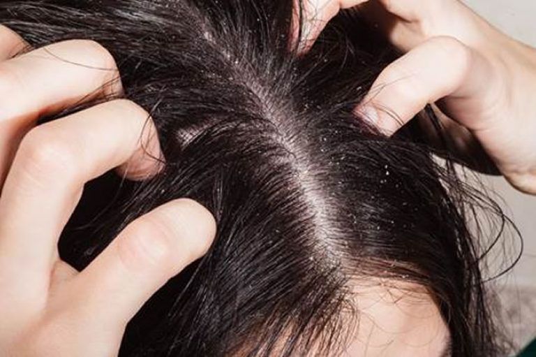 Lợi ích bất ngờ của gừng cho tóc và da - Hình 5