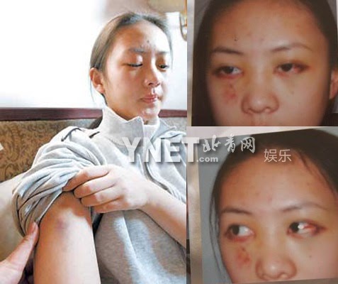 Địch Lệ Nhiệt Ba bị đàn chị giật vai trắng trợn, cùng chồng lập kế hãm hại cực rợn người? - Hình 6