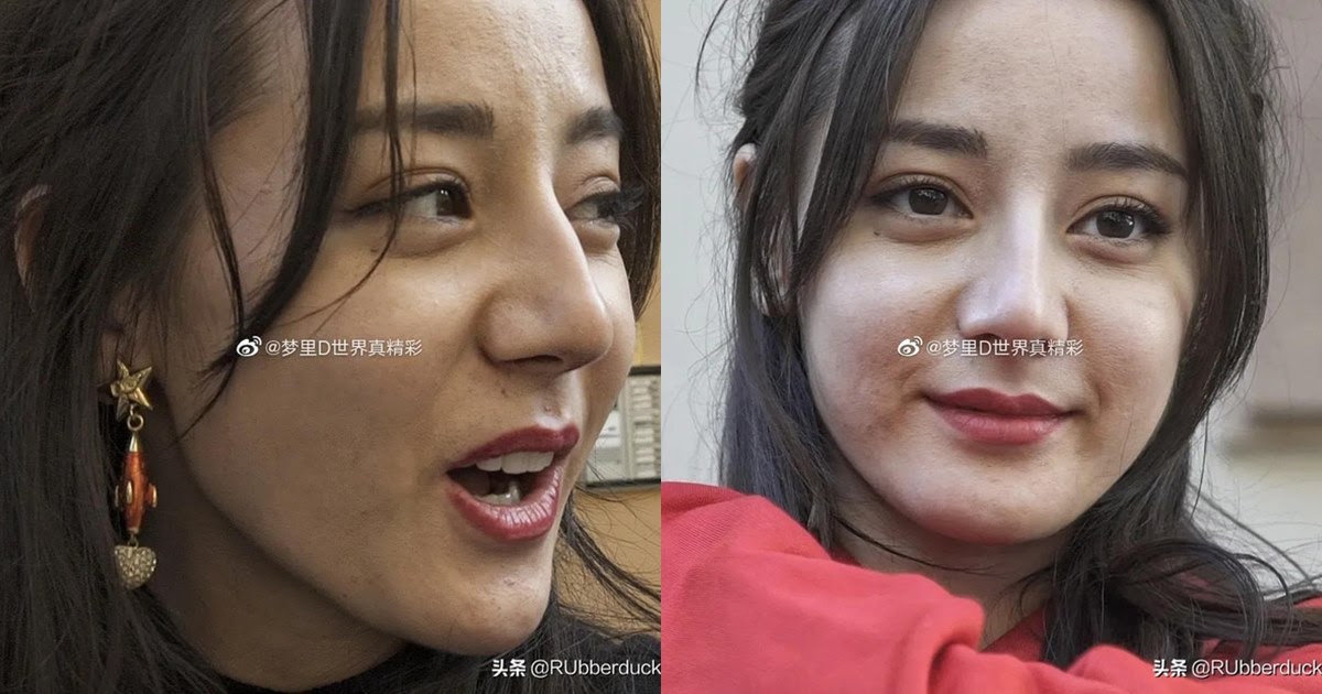 Địch Lệ Nhiệt Ba lộ nhan sắc thật qua ảnh chưa photoshop, da sần sùi chi chít mụn nhìn sởn gai ốc - Hình 8