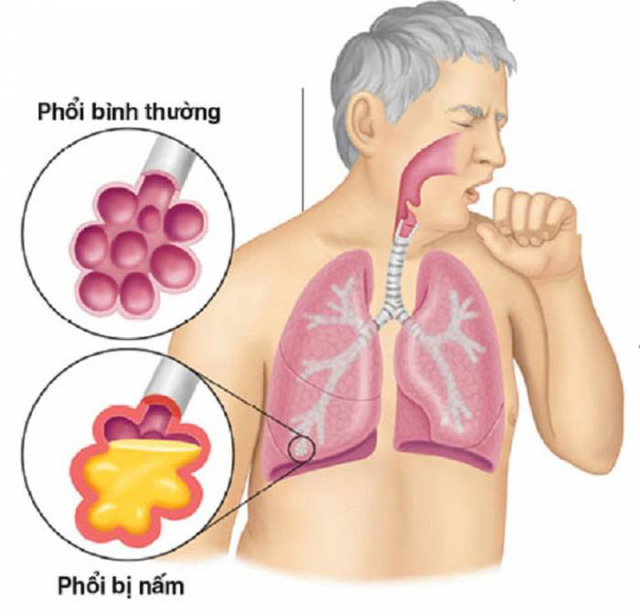 cham soc phoi dung cach trong mua dich covid 19 94e 6243110