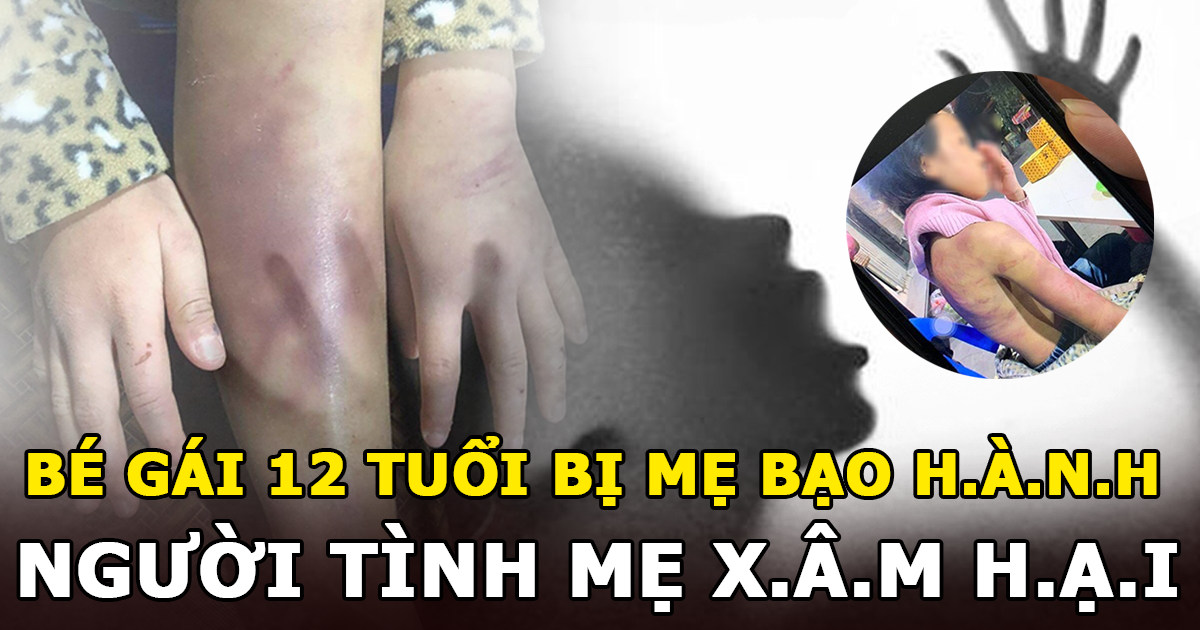 Bé gái 12 tuổi nghi bị mẹ bạo hành, người tình của mẹ xâm hại nhiều lần - Hình 6