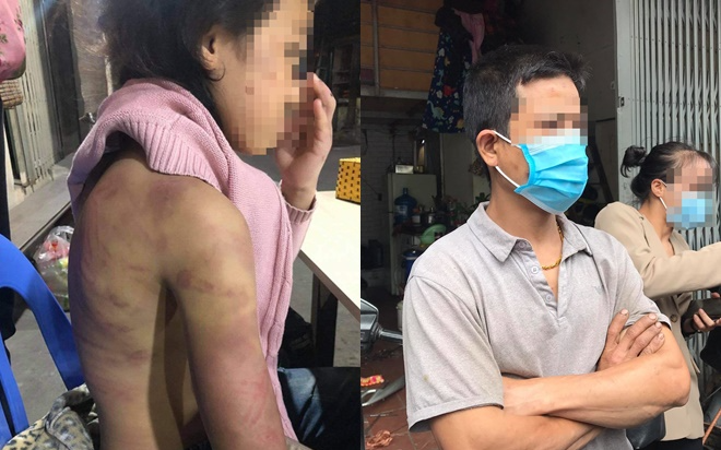 Bé gái 12 tuổi nghi bị mẹ bạo hành, người tình của mẹ xâm hại nhiều lần - Hình 5