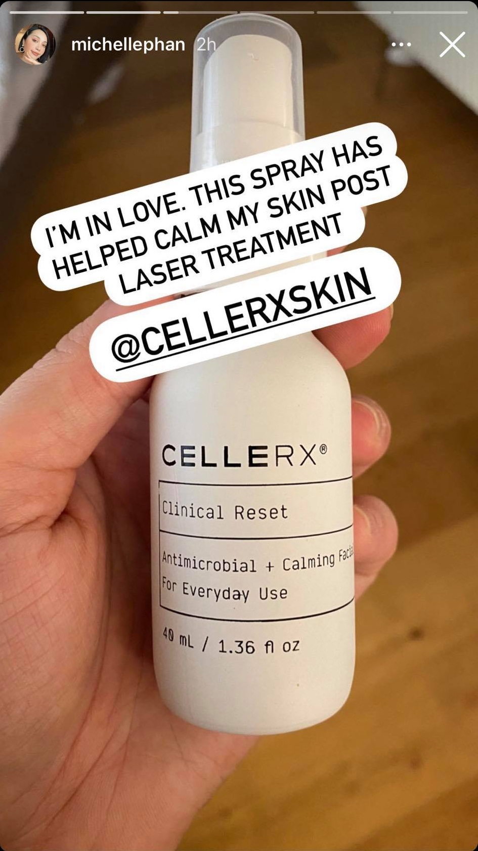 Gần Tết còn đi làm laser, chị em đừng dại mà khéo lại nhận cái kết đắng như Michelle Phan - Hình 4