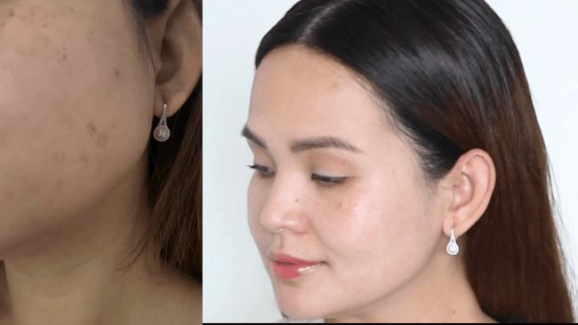 Sự đầu tư khôn ngoan nhất của nàng ngoài 30 là một lọ serum xử lý nhanh gọn nếp nhăn, thâm nám để trở về làn da căng mướt của tuổi 20 - Hình 2