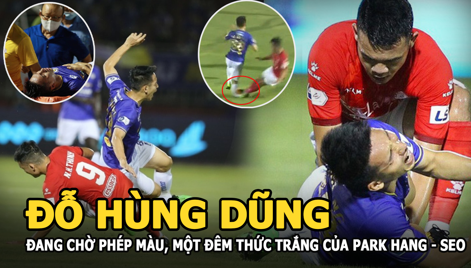 Đỗ Hùng Dũng bị Hoàng Thịnh đốn gãy chân, Park Hang Seo và CLB Hà Nội lo xốt vó - Hình 6
