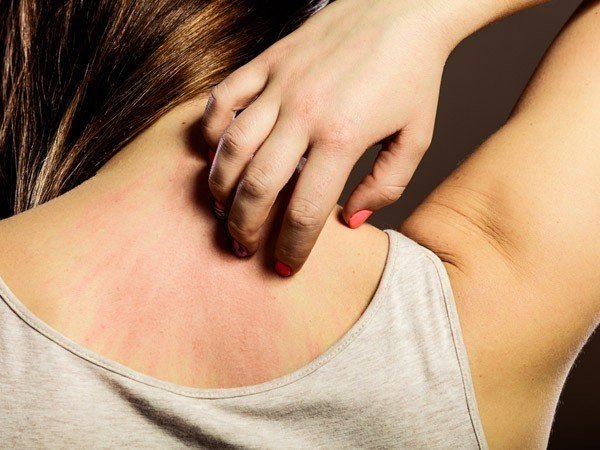 Ngứa 7 bộ phận này đừng chủ quan, đi khám ngay kẻo ung thư hỏi thăm - Hình 1