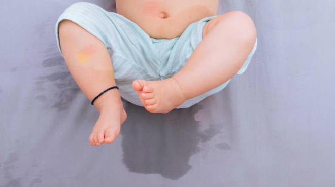 Dị tật khiến tinh hoàn bé trai thay đổi hình dạng đột ngột - Hình 1