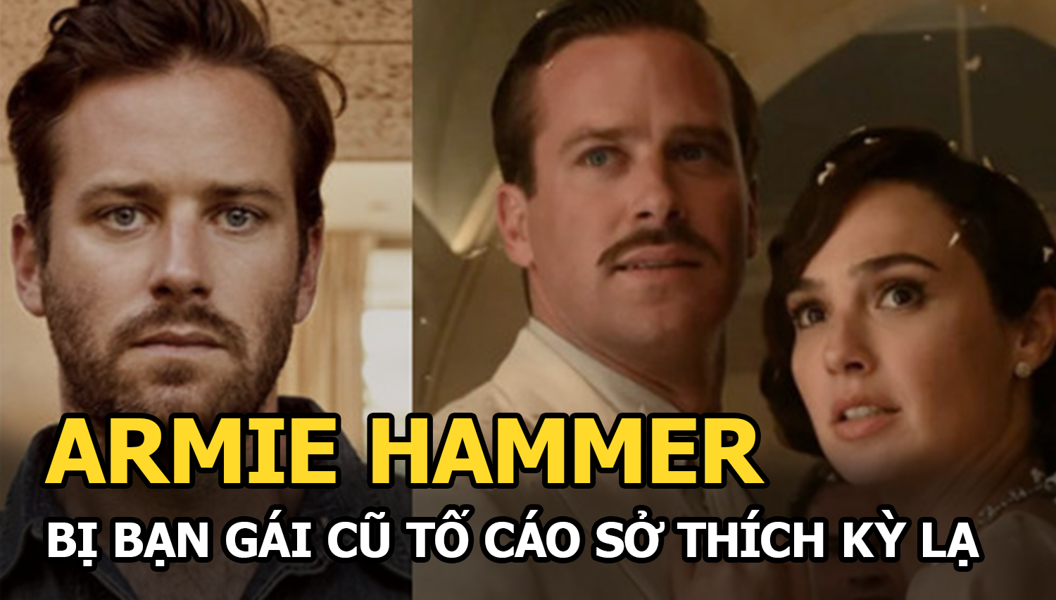 Armie Hammer - Tài tử Call Me By Your Name bị bạn gái cũ tố cáo sở thích kỳ lạ - Hình 4