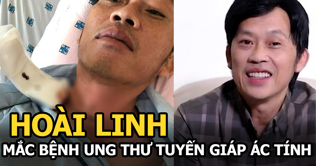 Hoài Linh phẫu thuật ung thư tuyến giáp giữa ồn ào vụ hơn 13 tỷ tiền từ thiện - Hình 5