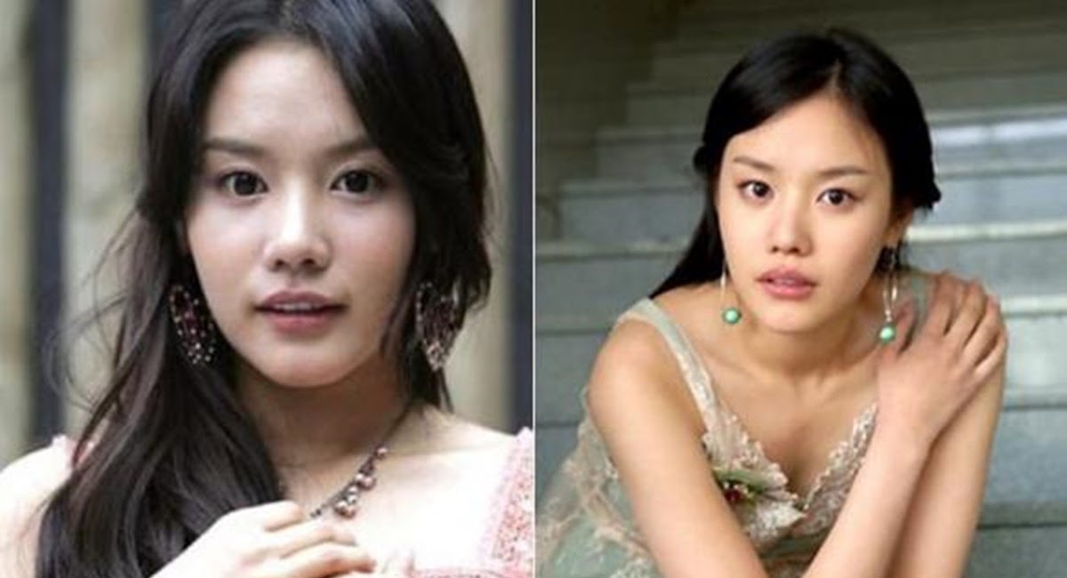 Kim Ah Joong Sắc đẹp ngàn cân thay đổi không ai nhận ra hậu dao kéo? - Hình 3