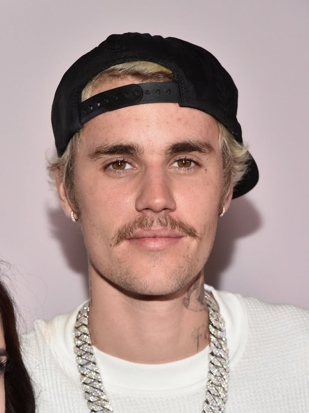 Justin Bieber mắc bệnh hiếm gặp dẫn đến xuống sắc không phanh - Hình 1