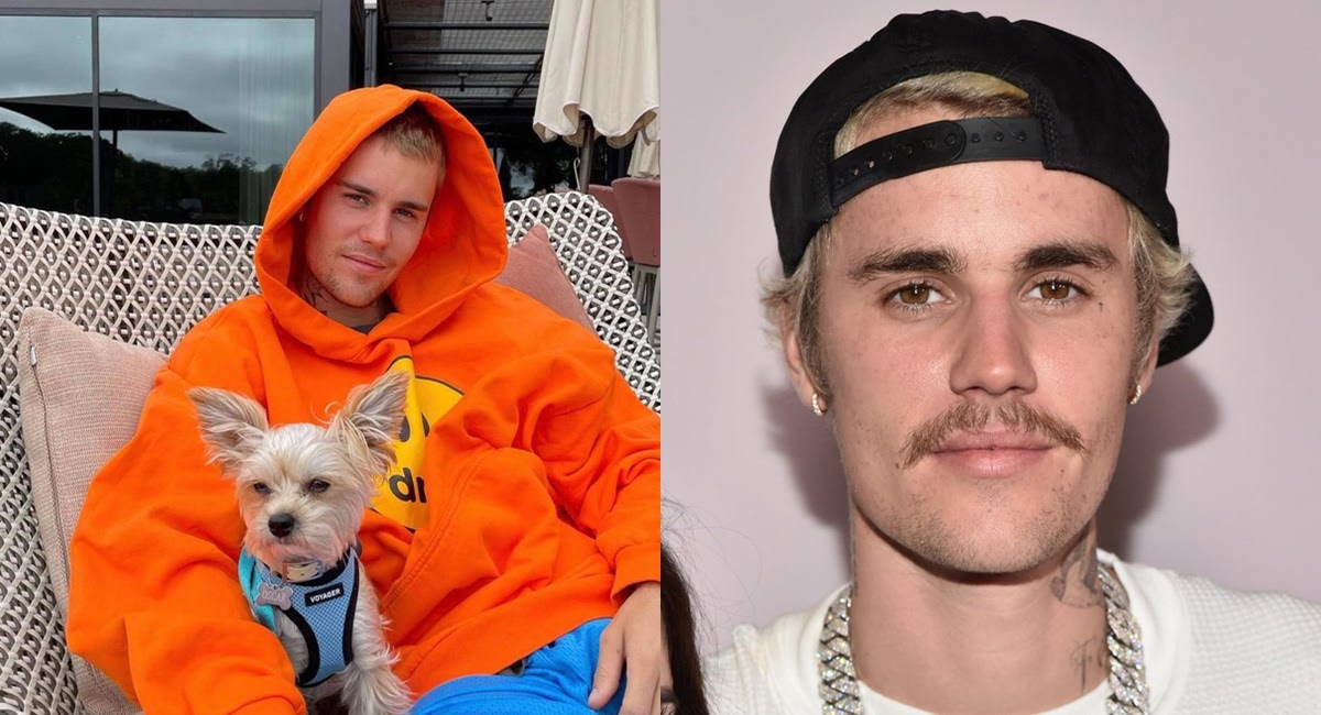 Justin Bieber mắc bệnh hiếm gặp dẫn đến xuống sắc không phanh - Hình 4