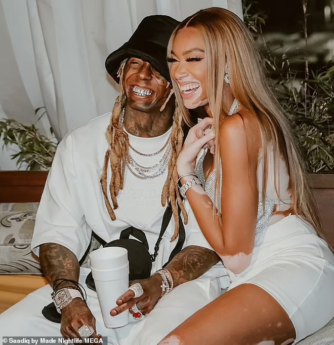 Siêu mẫu bạch biến Winnie Harlow mặc váy hở bạo đón tuổi 27 - Hình 6
