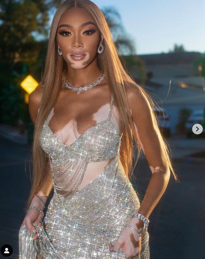Siêu mẫu bạch biến Winnie Harlow mặc váy hở bạo đón tuổi 27 - Hình 3
