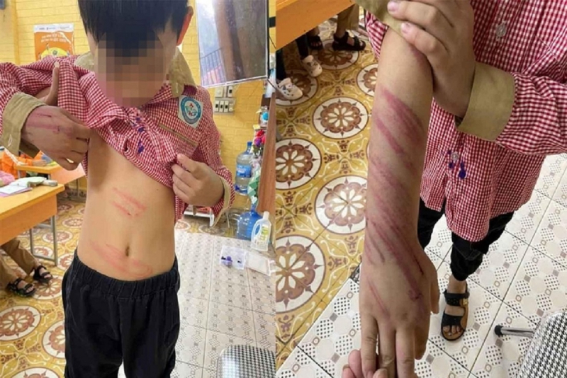 Bố dượng bạo hành con riêng của vợ khai bức xúc vì cháu nó hay trộm tiền - Hình 1