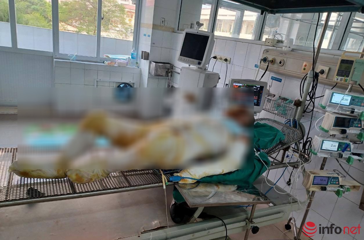 Vụ 3 con gái tẩm xăng đốt mẹ: Con rể tiết lộ tình trạng của người vợ đã trực tiếp châm lửa - Hình 6