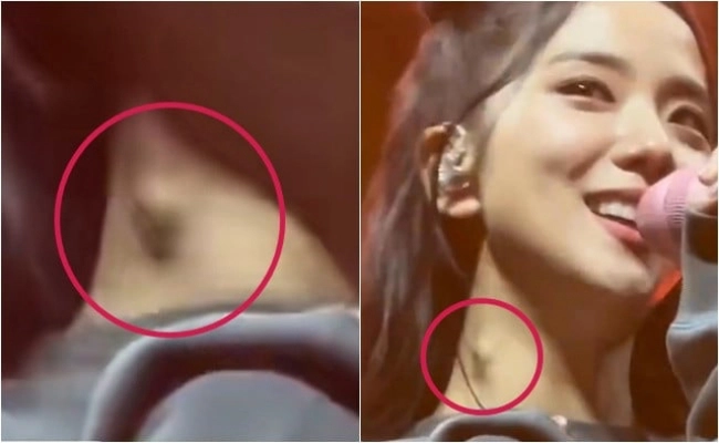 Jisoo phải nhập viện, Rosé cứu nguy Jennie, khẩn cầu fan 1 điều giữa concert vì sức khỏe báo động? - Hình 4