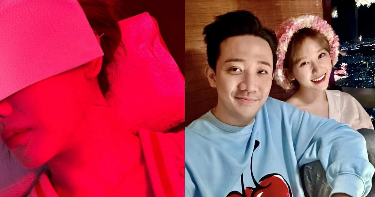 Hari Won gây lo lắng khi tiết lộ hình ảnh khuôn mặt bị cắm kim châm, Trấn Thành hành động gây sốt - Hình 8