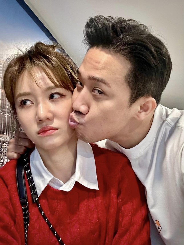Hari Won gây lo lắng khi tiết lộ hình ảnh khuôn mặt bị cắm kim châm, Trấn Thành hành động gây sốt - Hình 5