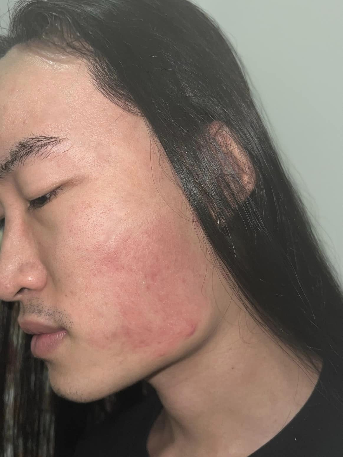 Người mẫu phi giới tính bị phun nước bọt, tác động vật lý tại chung cư vì khác biệt ngoại hình - Hình 3