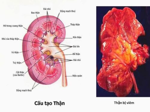 viem than be than cap dau hieu nhan biet som va cac phuong phap dieu tri 872 6352387