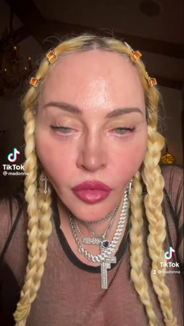 Sex symbol Madonna makes netizens panic with her terrifyingly deformed face - Photo 1