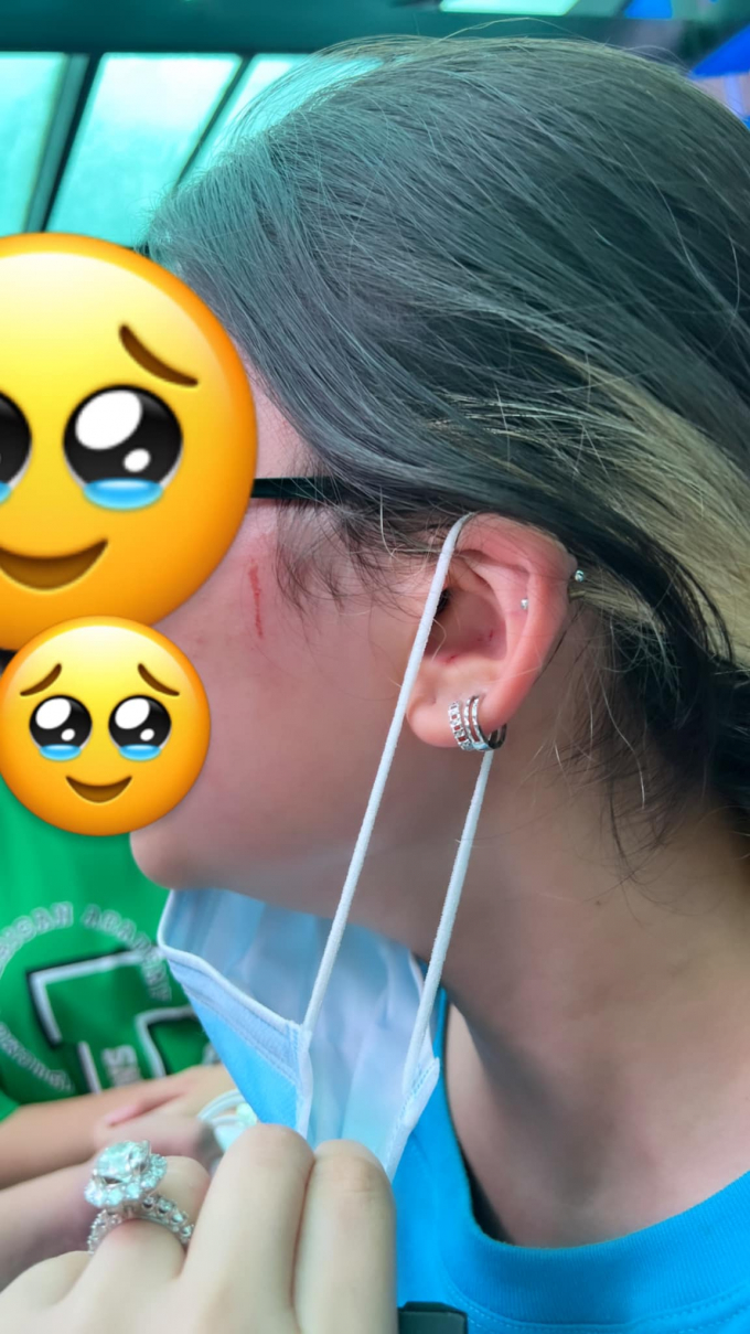 Trường quốc tế phủi bỏ trách nhiệm vụ học sinh ẩu đả nhận kết đắng - Hình 3