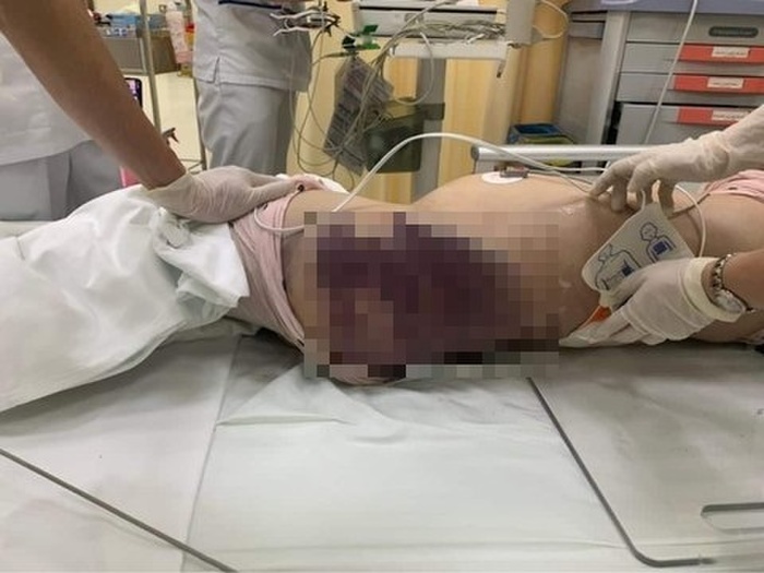Thêm tình tiết vụ bé gái 8 bị bạo hành tử vong: Nguyễn Trung Kim Thái còn tàn ác hơn dì ghẻ - Hình 2
