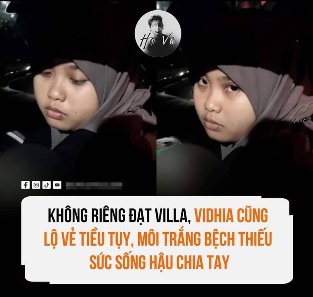 Tình cũ Đạt Villa bị mỉa mai có nhan sắc đáng sợ, không lung linh như trên clip - Hình 1