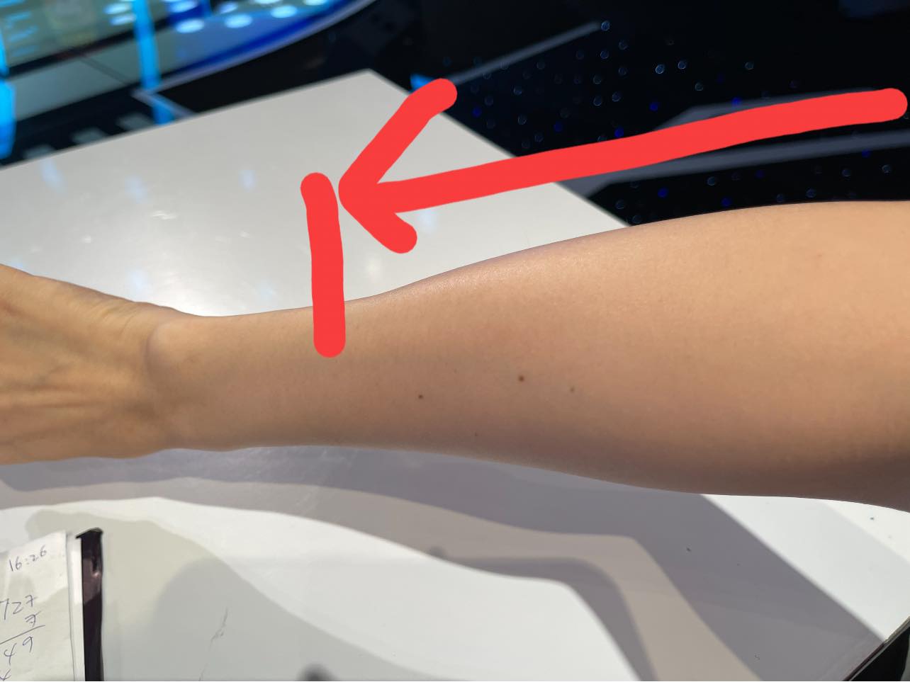 Hari Won tiếp tục thông báo tình trạng sức khỏe, tay sưng to, netizen thắc mắc Trấn Thành ở đâu? - Hình 2