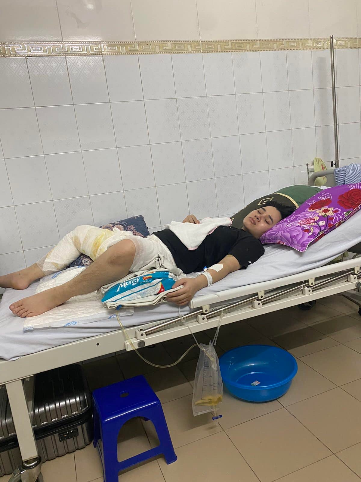 Nhà hàng lẩu làm khách bỏng nặng nhưng xem thường tính mạng, nổi da gà khi xem vết thương - Hình 1