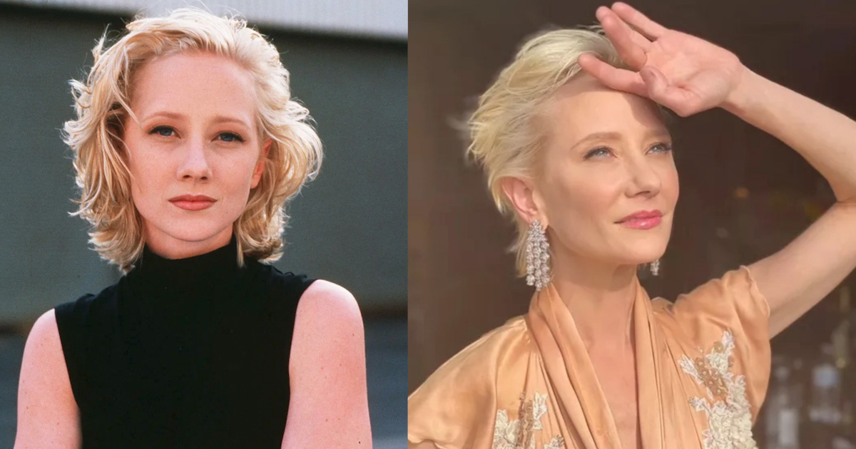 Anne Heche - Nữ diễn viên qua đời ở tuổi 53, hiến tặng trái tim là ai? - Hình 6