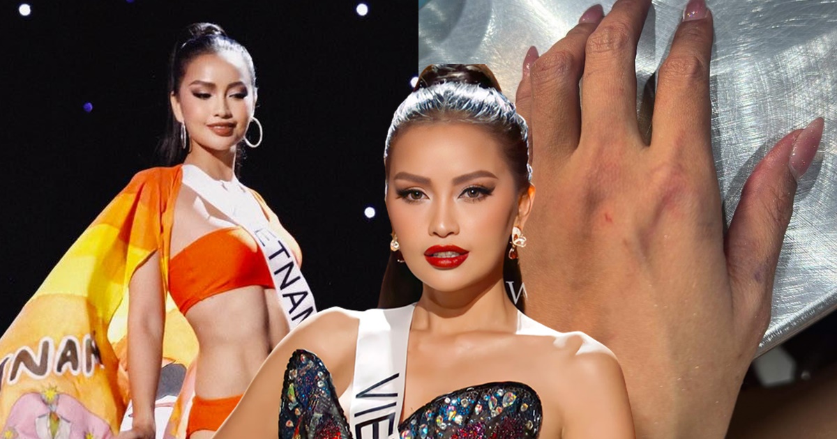 Ngọc Châu chấn thương vẫn lọt top 3 bán kết Miss Universe, chủ mới ưu ái: Tín hiệu đăng quang? - Hình 12