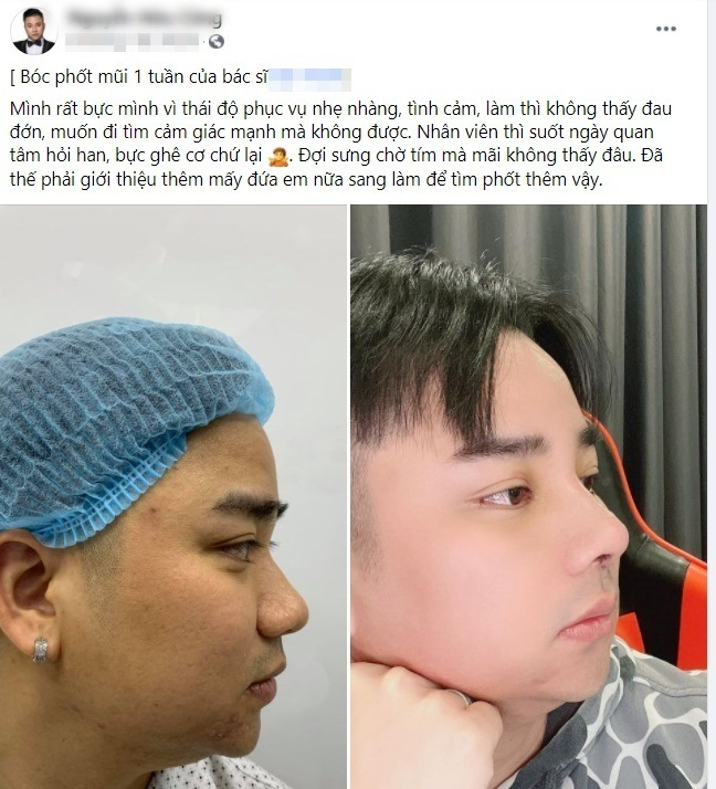 Hữu Công: Bỏ diễn để kinh doanh, chia tay Linh Miu đi lấy vợ, bà xã mang thai 4 lần mới được làm bố - Hình 7