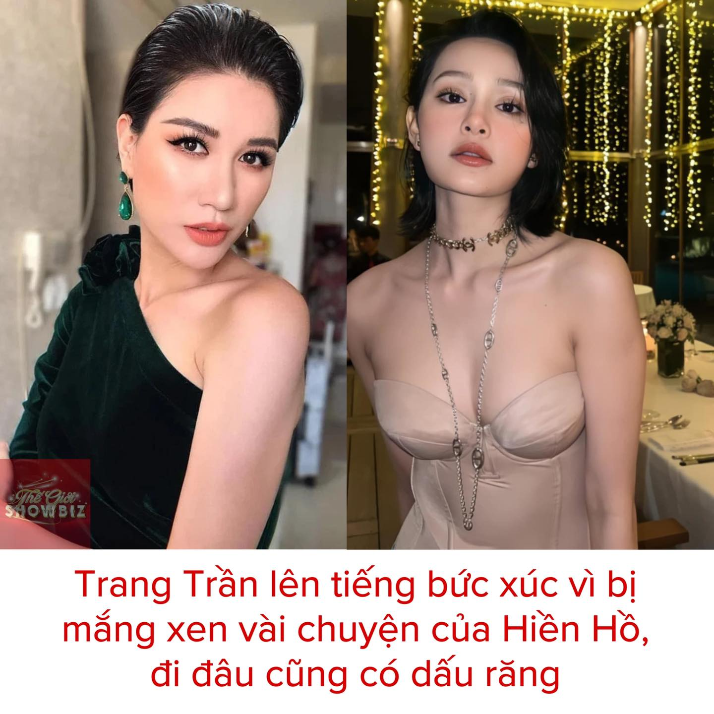 Bị nói đi đâu cũng có dấu răng, Trang Trần tức giận đáp trả: Ai cũng có quyền nhiều chuyện - Hình 2