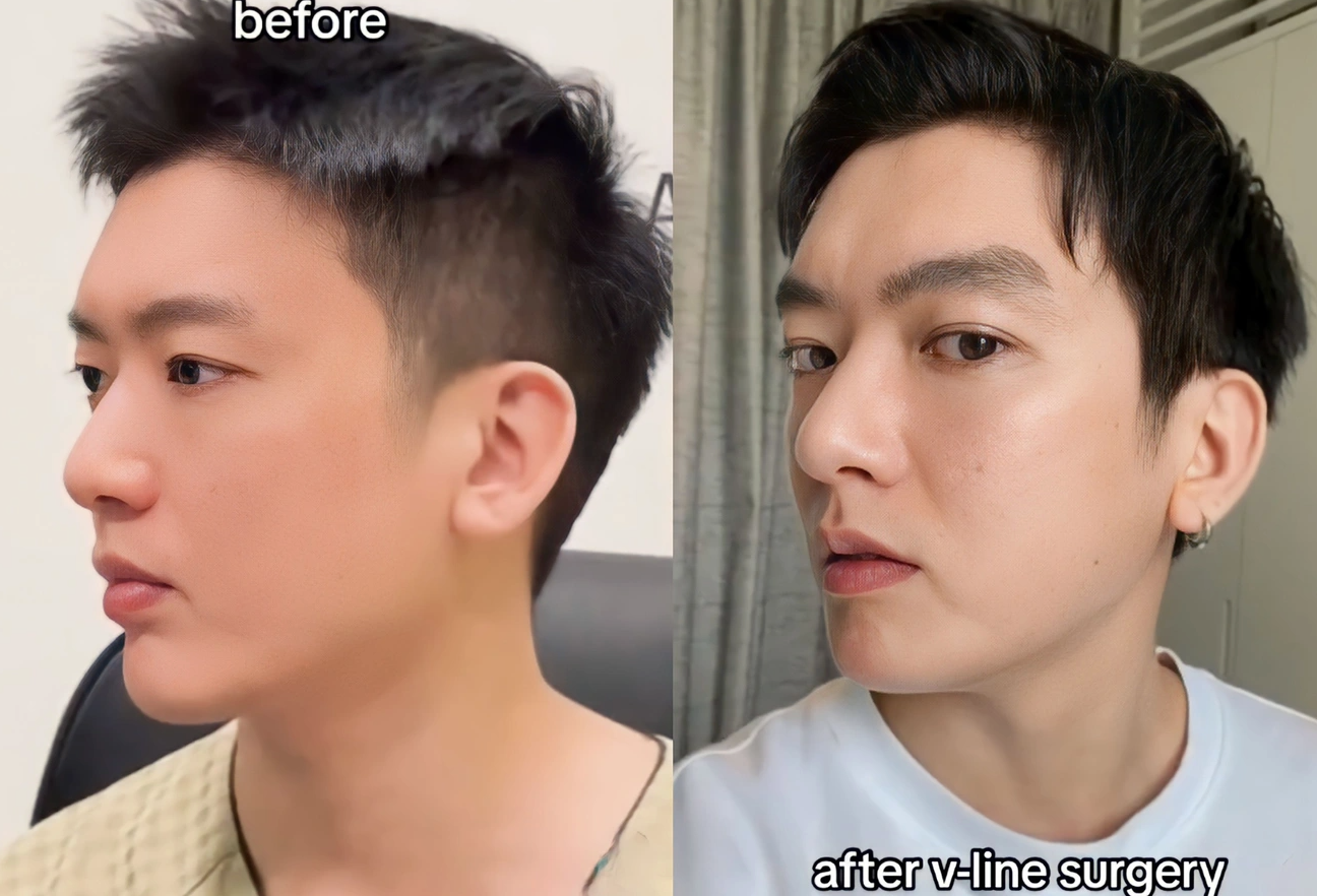 Brian Tran: The male celebrity had a chin surgery, was once entangled in rumors of being in love with Bao Anh, and is famous for his uncle-nephew love story - Photo 12