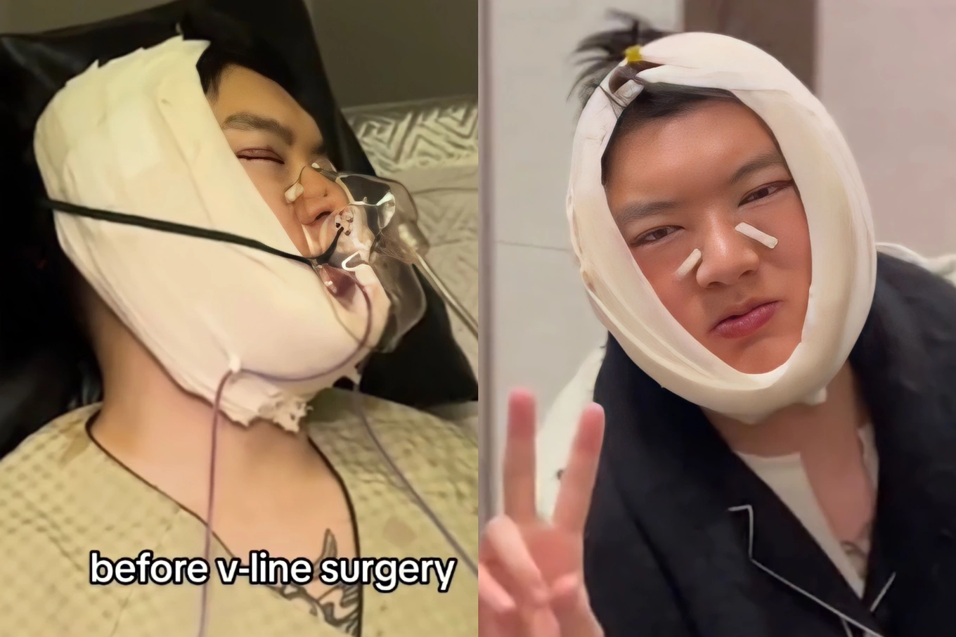 Brian Tran: The male celebrity had a chin surgery, was once entangled in rumors of being in love with Bao Anh, and is famous for his uncle-nephew love story - Photo 11