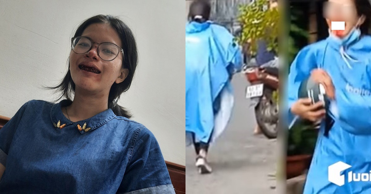 NÓNG: Nữ sinh bị tai nạn gãy hết hàm răng tố hung thủ bỏ trốn, không chịu trách nhiệm - Hình 7