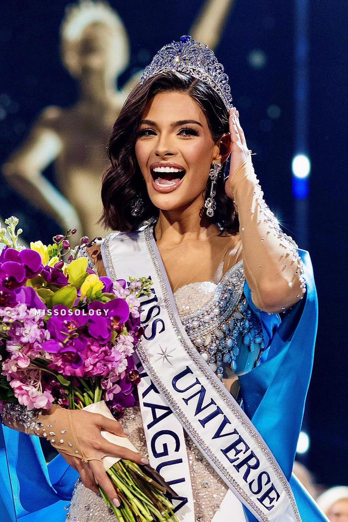 Tân Miss Universe lộ nhan sắc già chát sau đăng quang, bất ngờ được minh oan về trình độ tiếng Anh - Hình 1