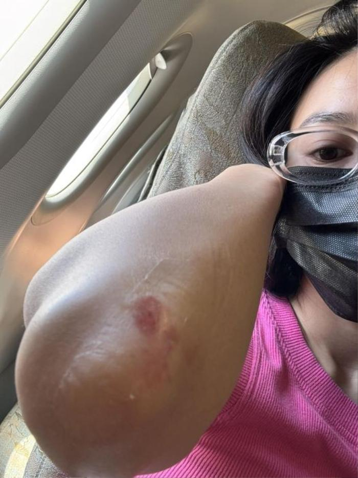 Lan Ngọc gặp sự cố lớn hậu ăn cưới Puka - Gin Tuấn Kiệt, có thể sẽ vắng mặt ở hôn lễ tại HCM? - Hình 2