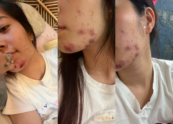 Nam Em lộ gương mặt đầy vết bầm, tiều tụy khó nhận ra, sức khỏe càng đáng báo động hậu ồn ào - Hình 2