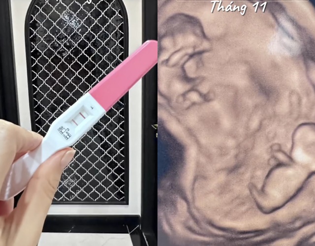 Phương Oanh tiết lộ hình siêu âm song thai, khoe một năm viên mãn khiến netizen ghen tị - Hình 1