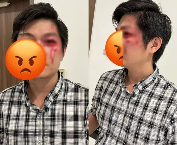 Diễn biến mới vụ chó thả rông: Chủ chó gặp xin lỗi, người bố quyết không đồng ý hòa giải - Hình 2