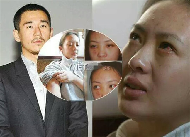 Trương Mặc - Quý tử ngỗ ngược của Trương Quốc Lập: Ra tù vào tội vì nghiện ngập vẫn làm giám đốc - Hình 5