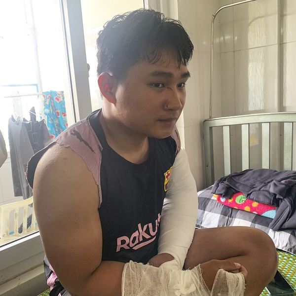 Vụ shipper bị tác động gãy 2 tay: Người ra tay là dân cộm cán, chính thức bị xử lý pháp luật - Hình 1