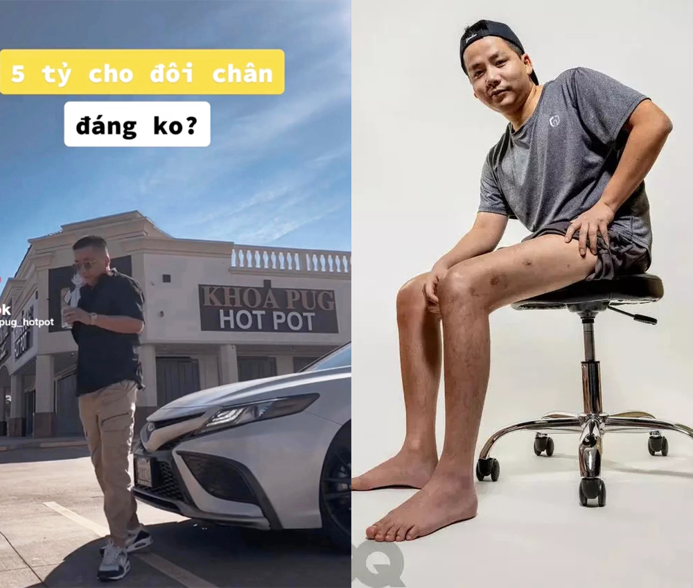 Nhan sắc Bà Tân Vlog sau 4 tháng phẫu thuật thẩm mỹ: Quá giống Quỳnh Trần JP ở 1 điểm này! - Hình 5