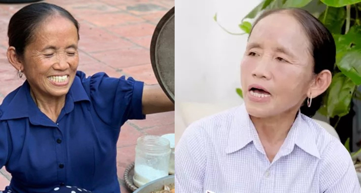 Nhan sắc Bà Tân Vlog sau 4 tháng phẫu thuật thẩm mỹ: Quá giống Quỳnh Trần JP ở 1 điểm này! - Hình 3
